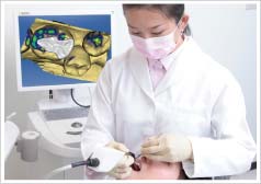 3Dカメラで口腔内を撮影
